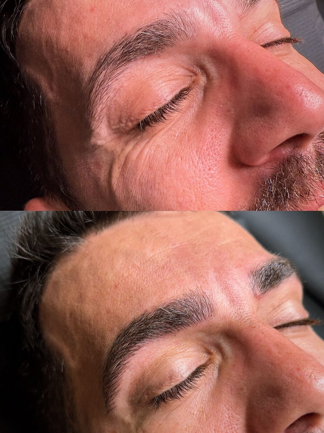 Microblading de cejas antes y después, influencia de técnica coreana