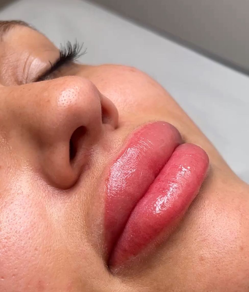 Lip micropigmentation result with a natural finish
